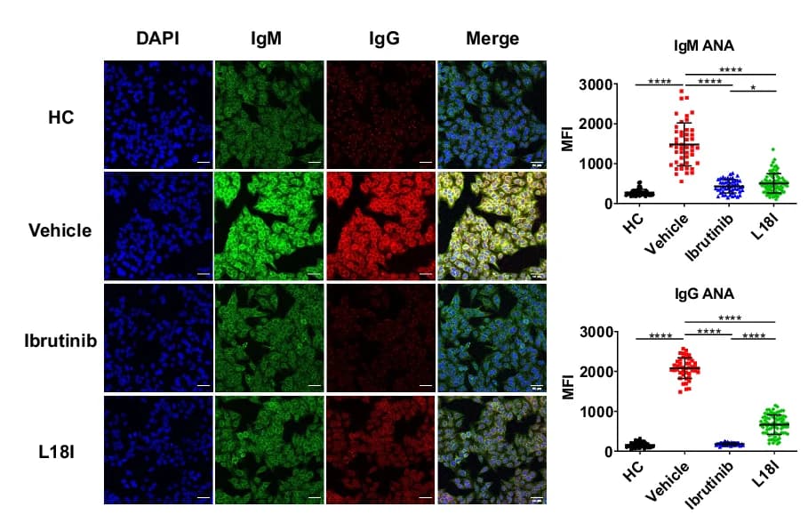 Open access visualization of Microscopy, Scatter Plot, OD 490nm, Serum Anti-dsDNA IgM, Serum Anti-dsDNA IgG