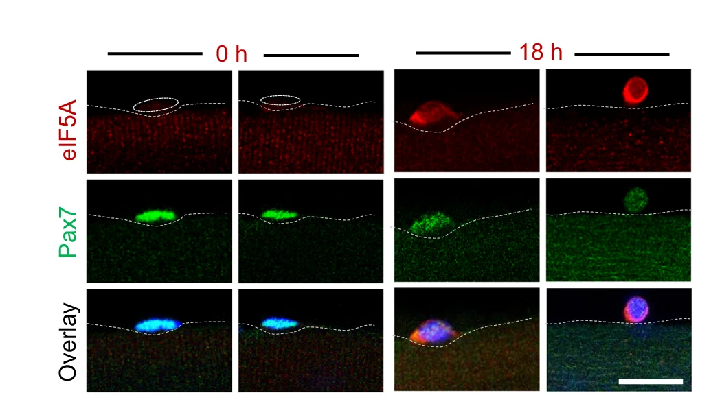 Open access visualization of Microscopy, Immunostaining, eIF5A, Pax7, Myofibers