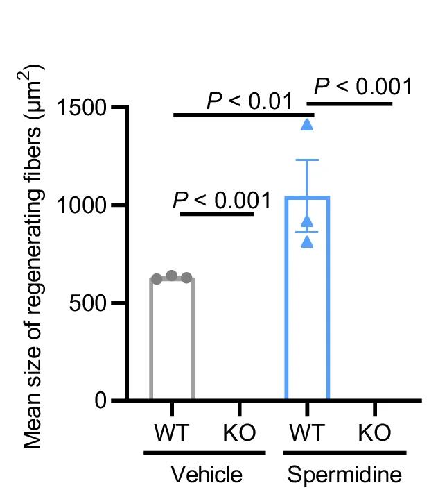 Open access visualization of Bar Plot, Error Bars, Cross-Sectional Area, Regenerated Myofibers, Centralized Nuclei