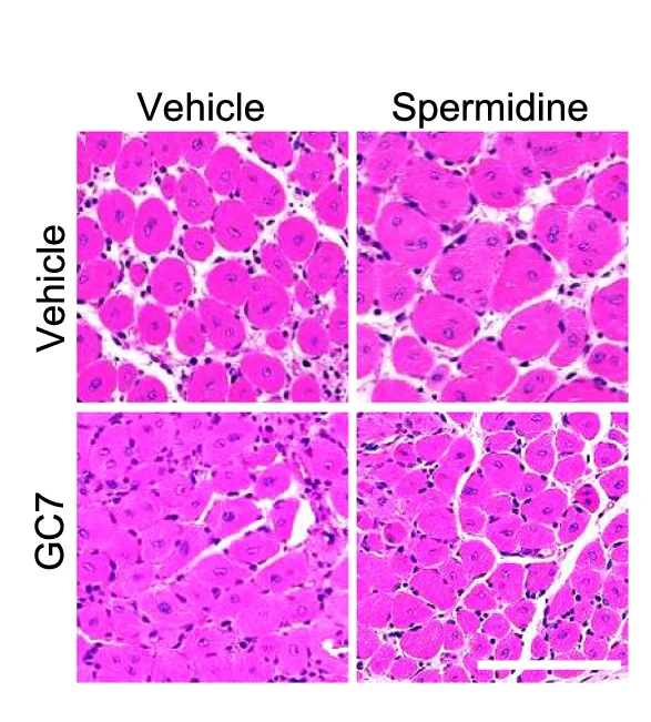 Open access visualization of Microscopy, H&E Staining, Cross-sections, TA Muscles, C57BL/6j Mice