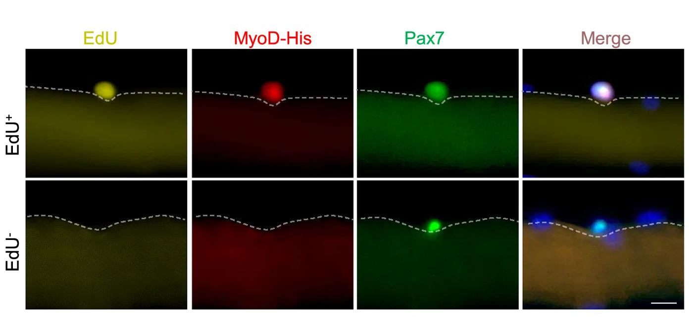 Open access visualization of Microscopy, Representative Images, EdU, MyoD-His, Pax7