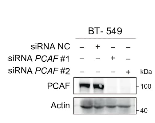 Open access visualization of Gel, Western Blot Analysis, PCAF Expression, Control, PCAF-Depleted
