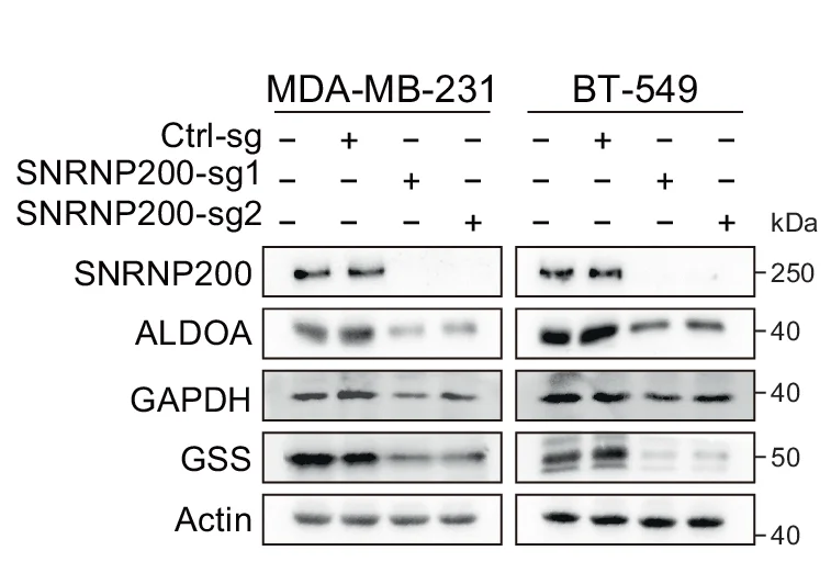 Open access visualization of Gel, Western Blot, Expression Levels, SNRNP200, ALDOA