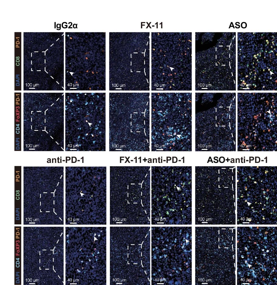 Open access visualization of Microscopy, Immunohistochemistry, PD1 + CD8 + T Cells, PD1 + CD4 + FOXP3 + T Cells, Tumor Microenvironment