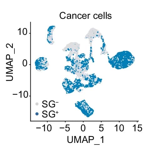Open access visualization of UMAP, Cancer Cells, AUCell Values, SG +, SG -