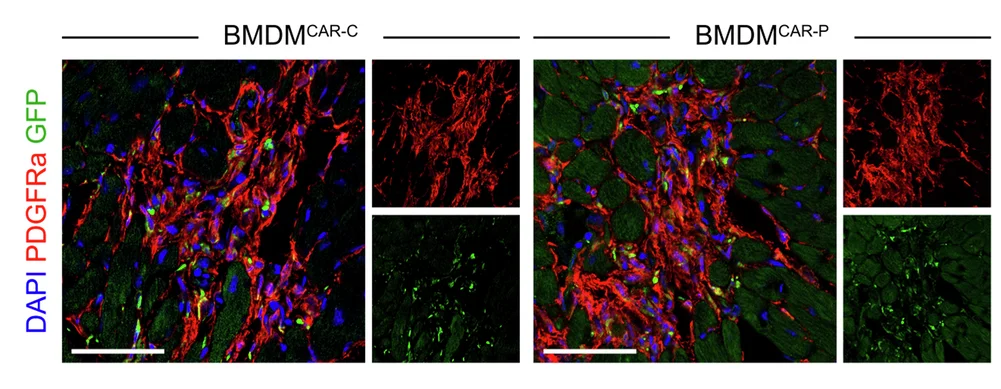 Open access visualization of Microscopy, Immunostaining, GFP, PDGFRa, BMDM CAR