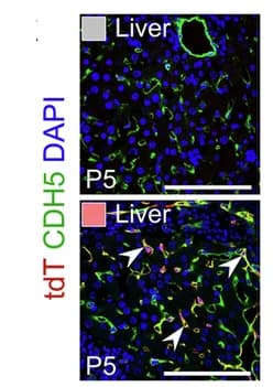 Open access visualization of Microscopy, Sectional Immunostaining, tdT, CDH5, Liver Sections