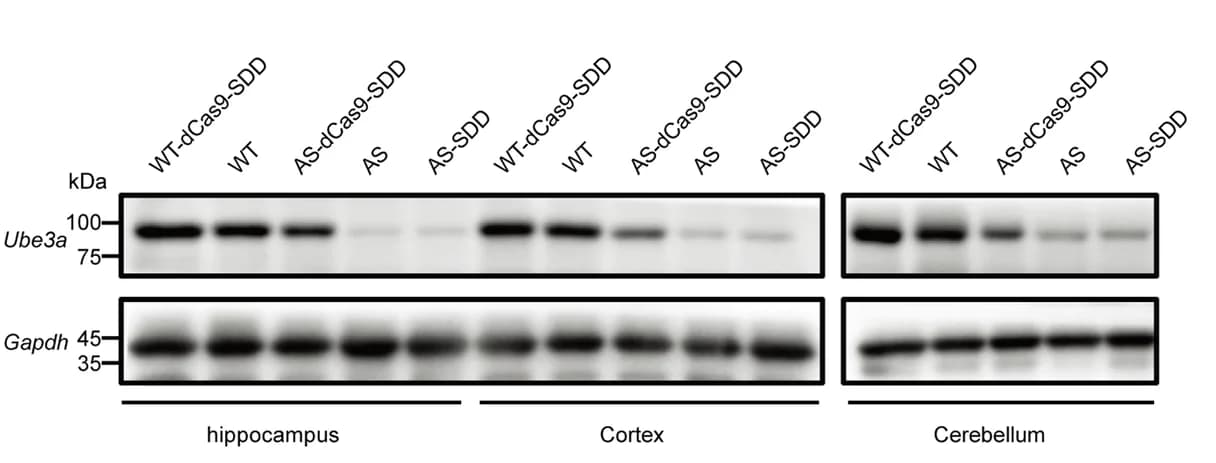 Open access visualization of Gel, Protein Expression, UBE3A, Brain Regions, Western Blotting