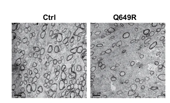 Open access visualization of Microscopy, Electron Micrographs, Optic Nerves, Control Mice, Med23 cKO Mutants