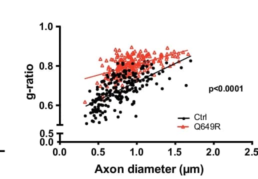 Open access visualization of Scatter Plot, Regression Plot, Myelinated Axons, Myelin g-ratio, Axon Diameters