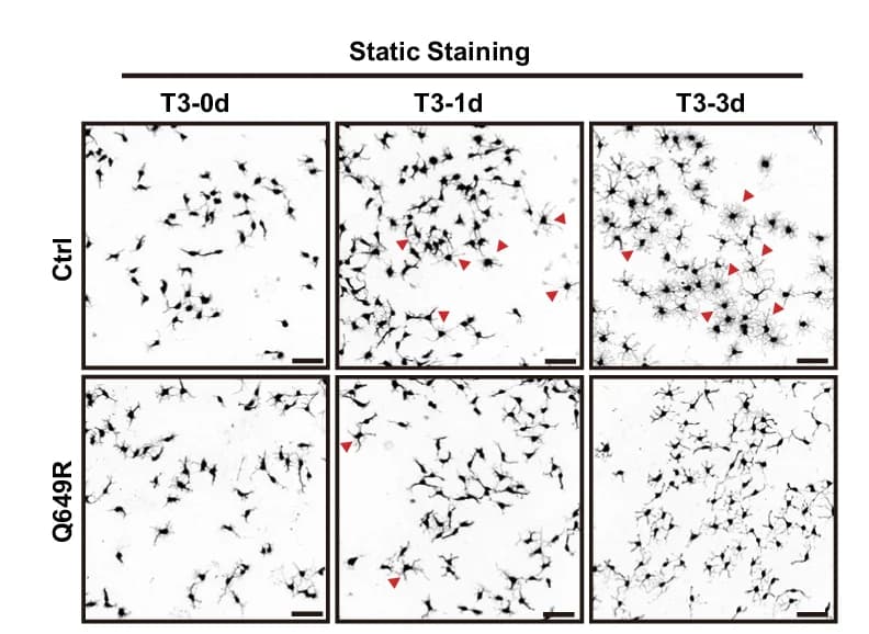 Open access visualization of Microscopy, Micrographs, Control Oligodendrocytes, Med23 Q649R Oligodendrocytes, Differentiation Medium