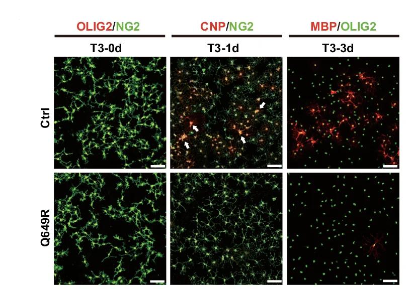 Open access visualization of Microscopy, Oligodendrocyte Precursor Cells, Control Mice, Med23 Q649R Mice, Differentiation Medium
