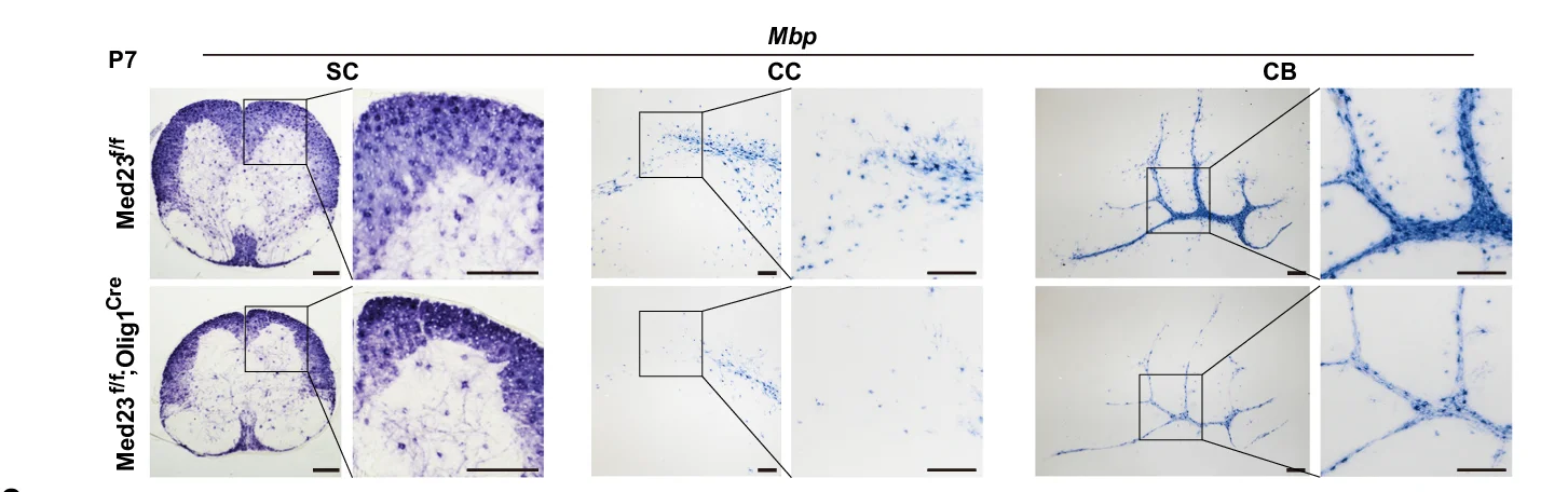 Open access visualization of Microscopy, In Situ Hybridization, Mbp, Plp1, Spinal Cord