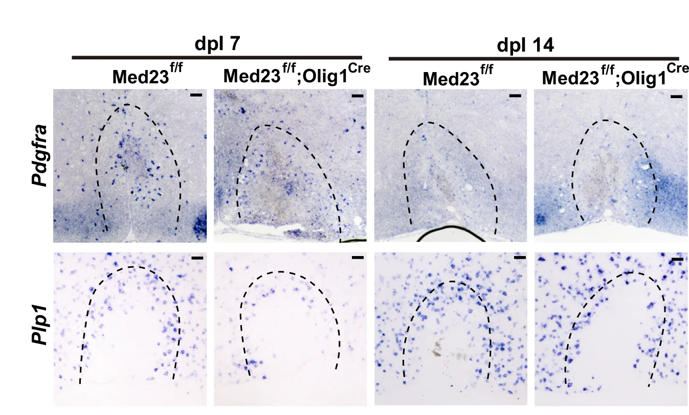 Open access visualization of Microscopy, In Situ Hybridization, Pdgfra, Plp1, Spinal Cord Lesions