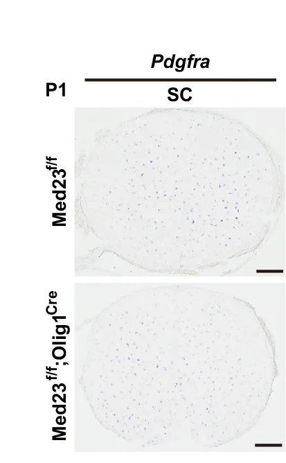Open access visualization of Microscopy, In Situ Hybridization, Spinal Cord Sections, Pdgfra, Control Mice