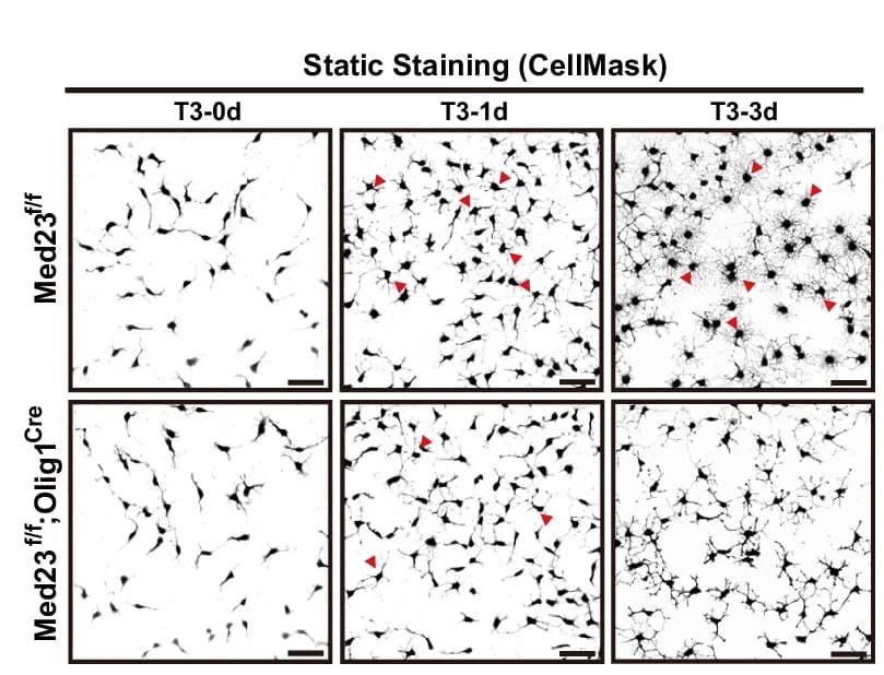 Open access visualization of Microscopy, Representative Images, Cell Morphological Differences, Control Cells, Med23 Knockout Cells