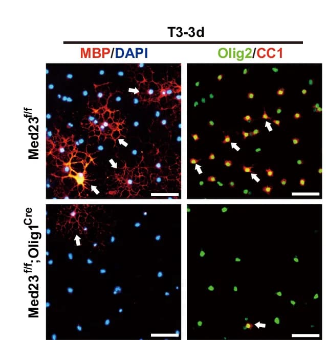 Open access visualization of Microscopy, Immunostaining, MBP, CC1, Olig2