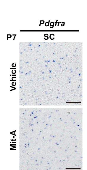 Open access visualization of Microscopy, In Situ Hybridization, Pdgfra, OPCs, Spinal Cords