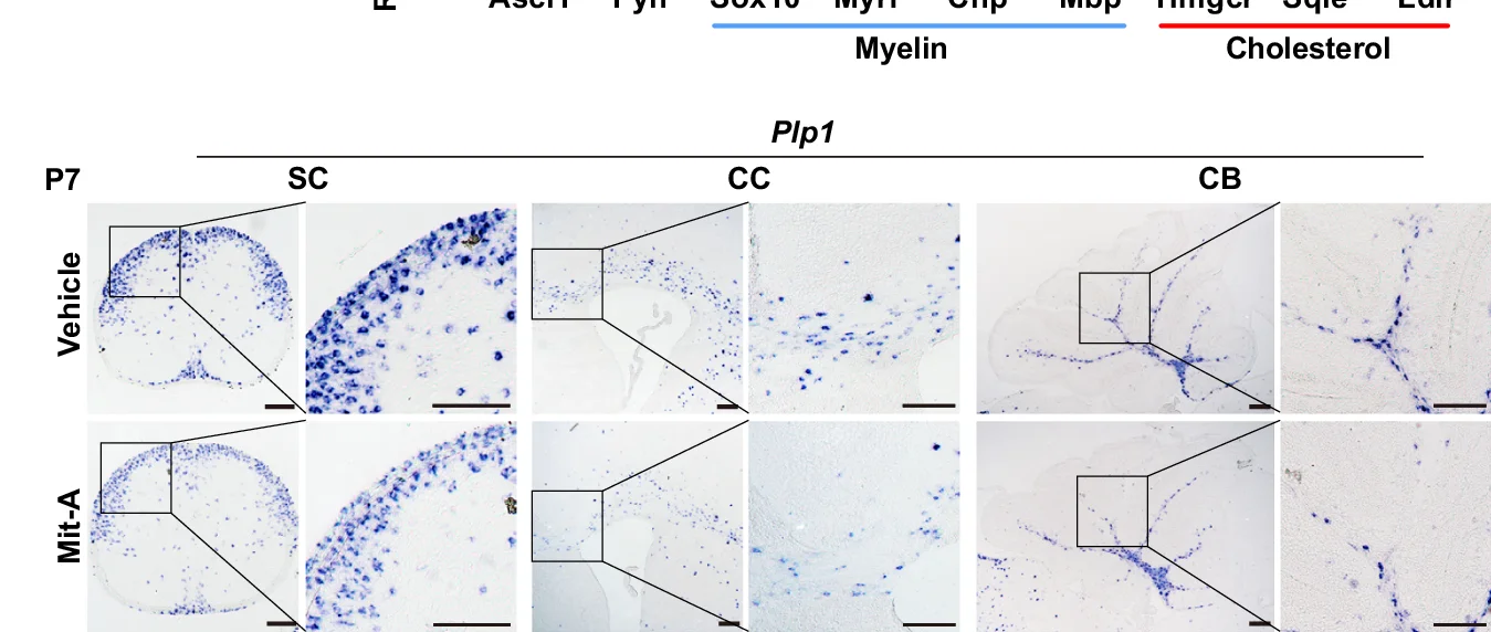 Open access visualization of Microscopy, In Situ Hybridization, Plp1, Brain Regions, Mice