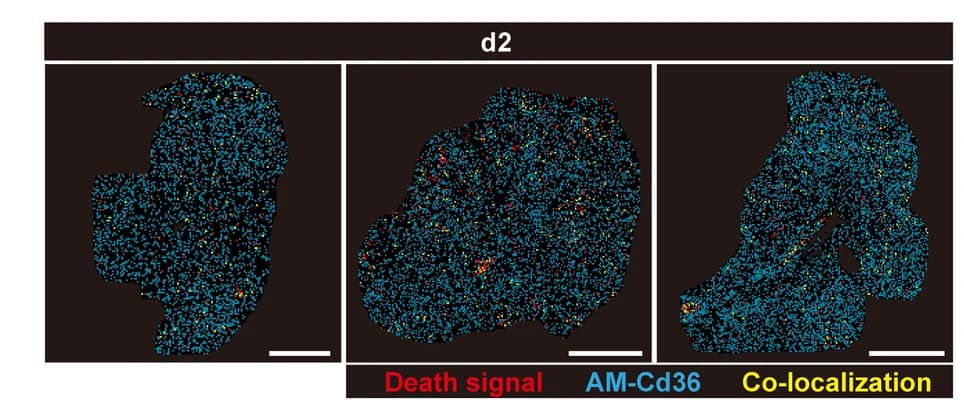 Open access visualization of Microscopy, Spatial Distribution, Cell Death-related Genes, Death Signal, AMs