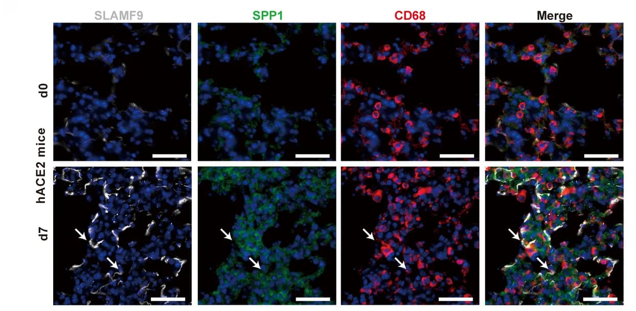 Open access visualization of Microscopy, Lung Sections, hACE2 Mice, SARS-CoV-2 Infection, Immunofluorescent Staining