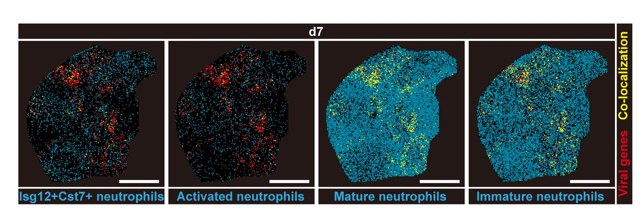 Open access visualization of Microscopy, Spatial Distribution, Viral Genes, Neutrophil Subtypes, Lung Section