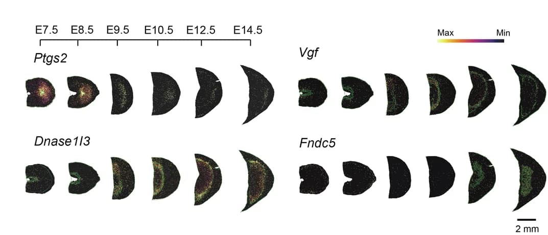 Open access visualization of Heatmap, Spatial Visualization, Gene Expression, Placenta