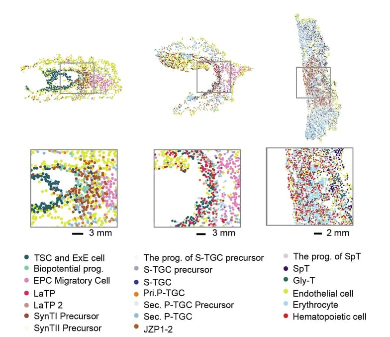 Open access visualization of Scatter Plot, Spatial Visualization, Deconvoluted Cell Types, Magnified Images, Cellular Composition