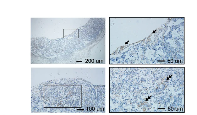 Open access visualization of Microscopy, IHC Staining, MDK Expression, Chorionic Plate, SynT