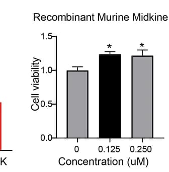 Open access visualization of Bar Plot, Error Bars, CCK-8 Assay, Endothelial Cells, iMDK