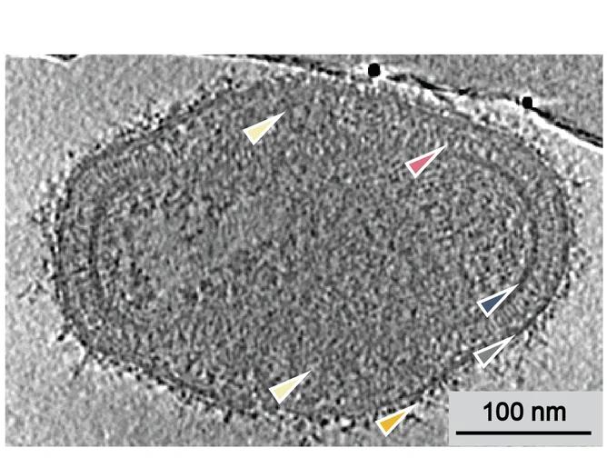 Open access visualization of Microscopy, Tomogram Slices, MV Particles, Inner Wall, Palisade