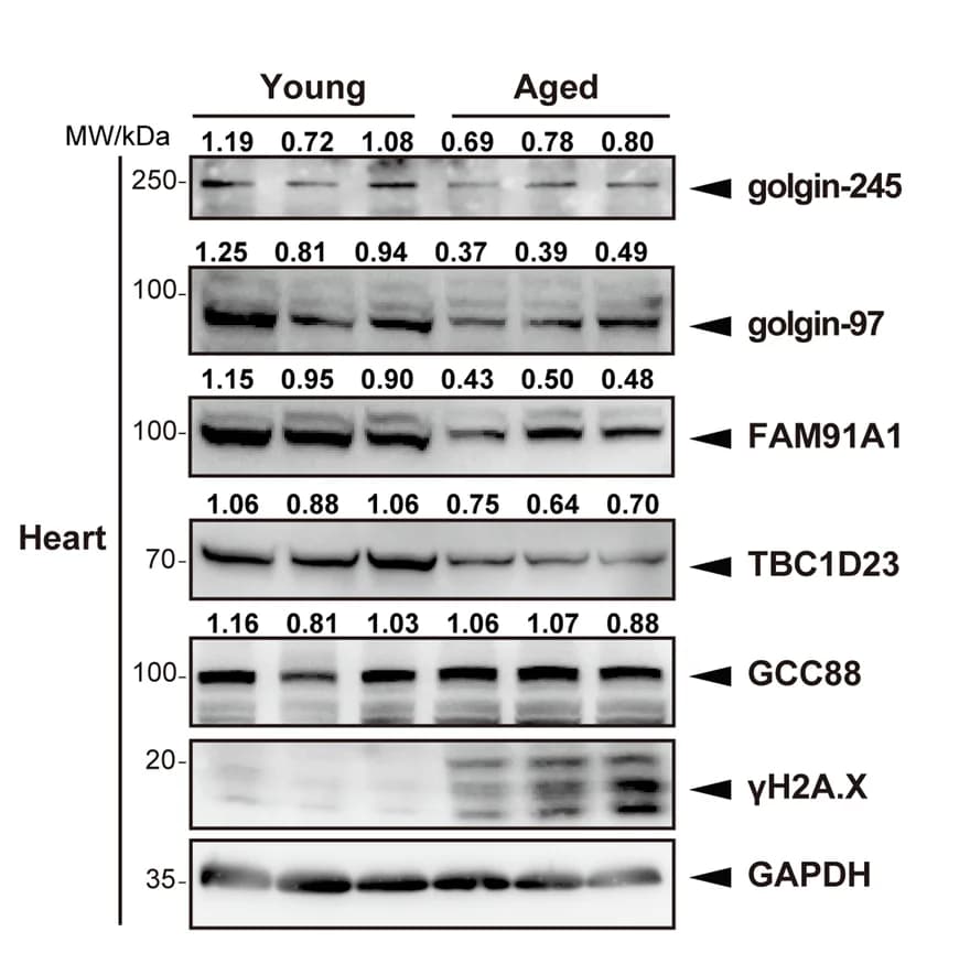Open access visualization of Gel, Hearts, Mice, TGN Tethering Factors, Immunoblotting