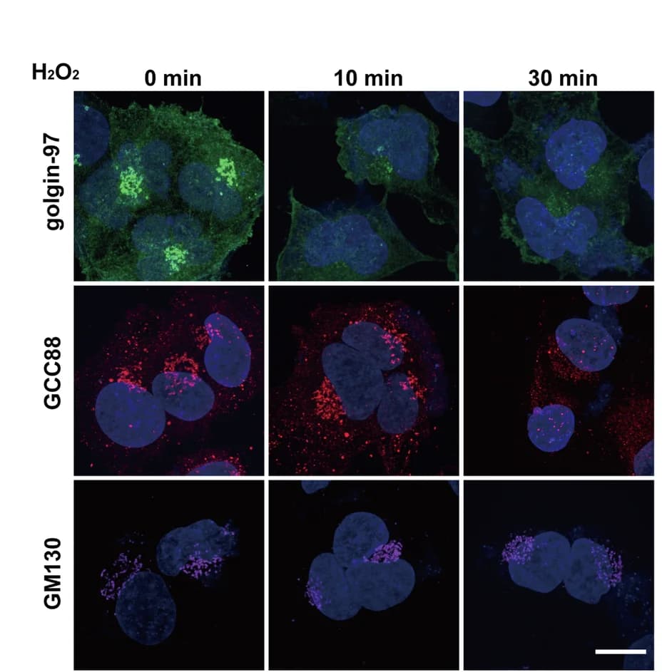 Open access visualization of Microscopy, Human Cerebral Microvascular Endothelial Cells, HCMEC/D3 Cells, H 2 O 2, Golgi Proteins