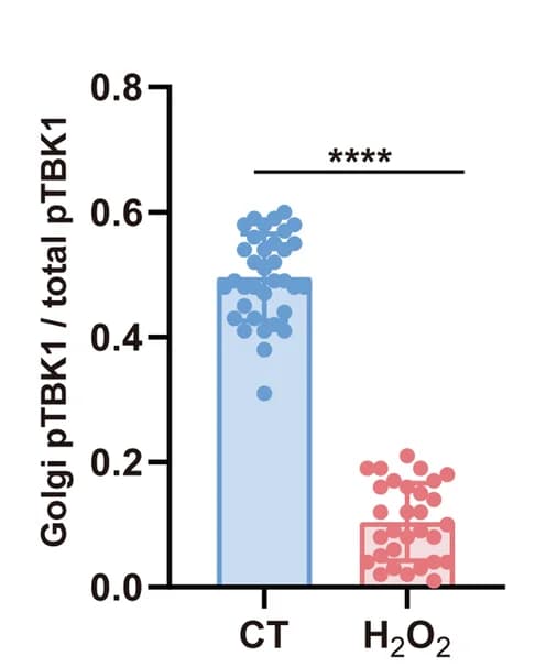 Open access visualization of Bar Plot, Scatter Plot, Golgi-Associated TBK1, GM130, Signal Intensity