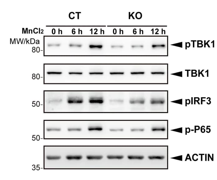 Open access visualization of Gel, BMDM Cells, Tbc1d23 KO Mice, MnCl 2, Immunoblotting Analysis