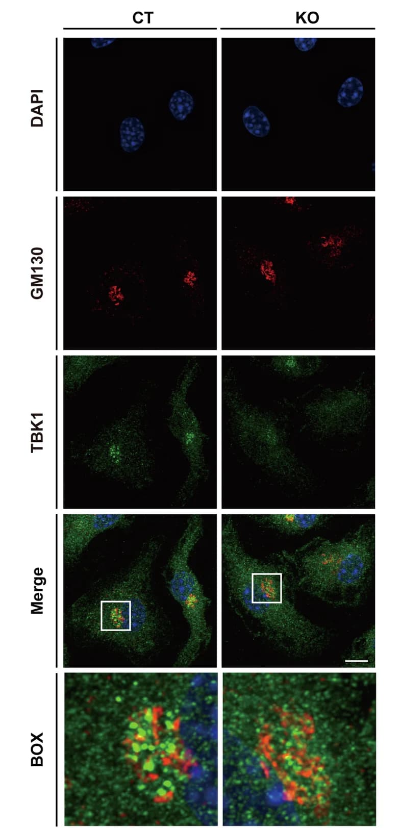 Open access visualization of Microscopy, BMDM Cells, DMXAA, TBK1, Confocal Fluorescence Microscopy