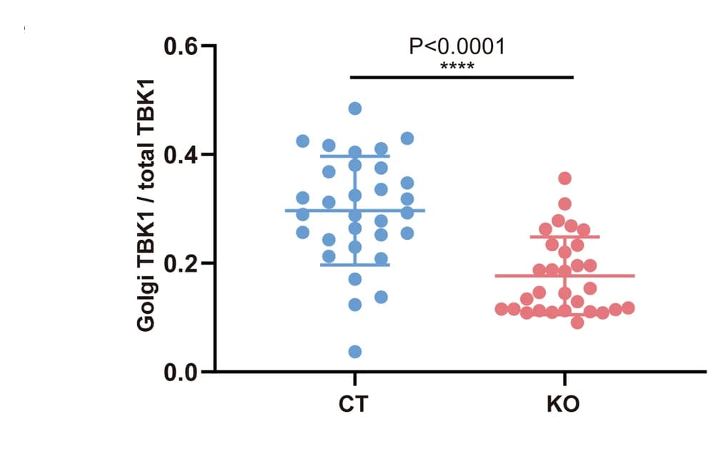 Open access visualization of Scatter Plot, Error Bars, Quantitative Analysis, Golgi TBK1, Total TBK1
