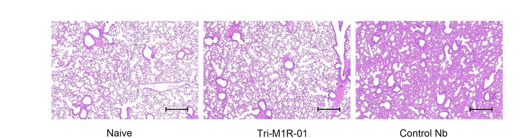Open access visualization of Microscopy, Hematoxylin and Eosin Staining, Lung Sections