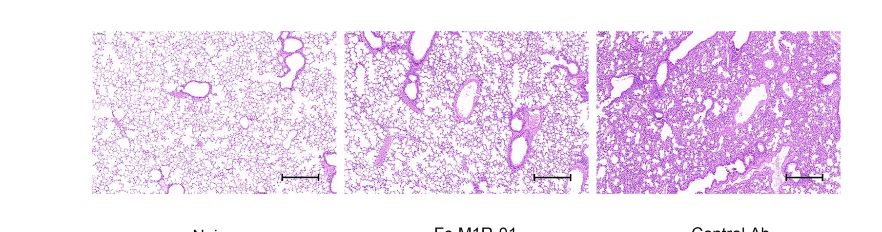 Open access visualization of Microscopy, H&E Staining, Lung Sections, One-way ANOVA, Statistical Significance