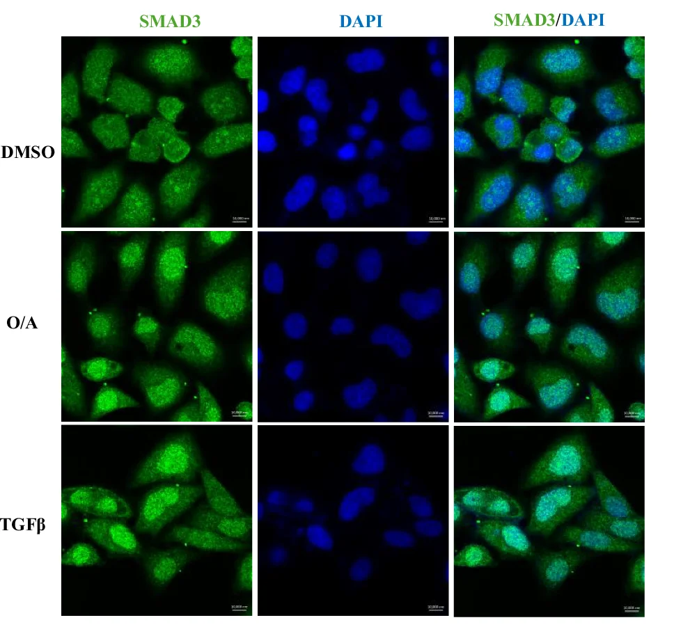 Open access visualization of Microscopy, HeLa WT Cells, Confocal Microscopy, Immunostaining, SMAD3