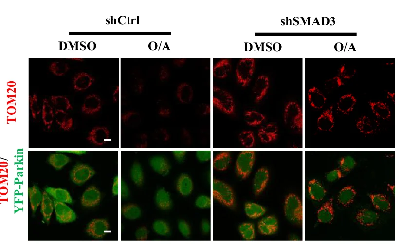 Open access visualization of Microscopy, HeLa YFP-Parkin Cells, SMAD3-knockdown Cells, OA, Confocal Microscopy