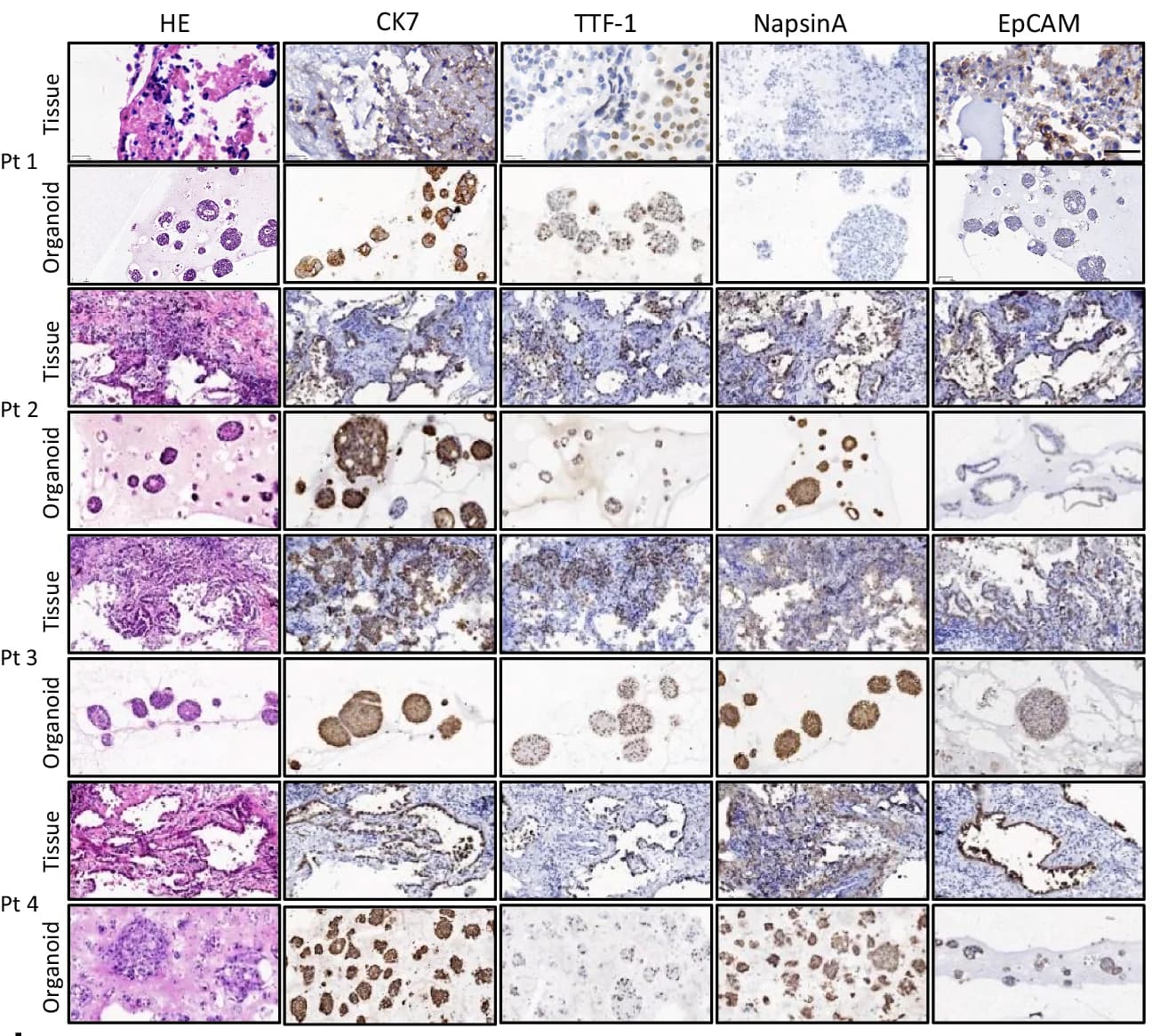 Open access visualization of Microscopy, HE Staining, IHC Staining, NSCLC Biopsies, Organoids