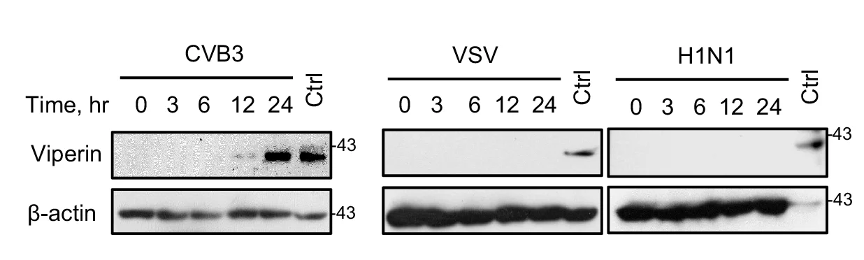 Open access visualization of Gel, Western Blot, Viperin Expression, HL-1 Cells, CVB3