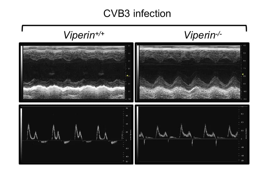 Open access visualization of Line Plot, Echocardiography, Representative Images