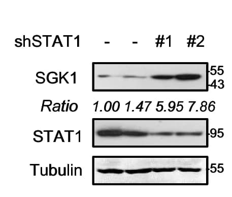 Open access visualization of Gel, Western Blot, SGK1, HL-1 Cells, shCtrl