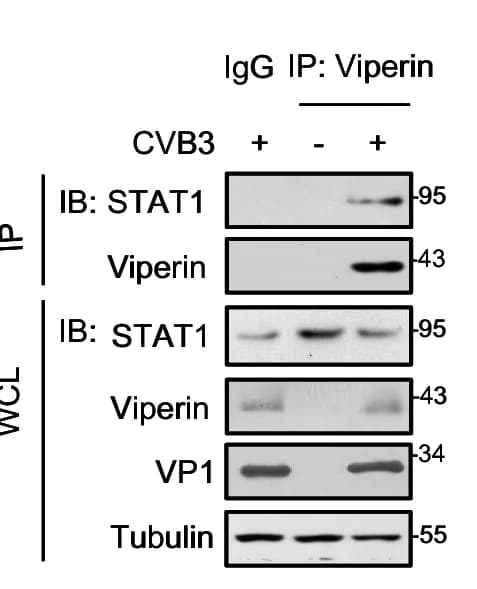 Open access visualization of Gel, Immunoprecipitation, Viperin, STAT1, HL-1 Cells