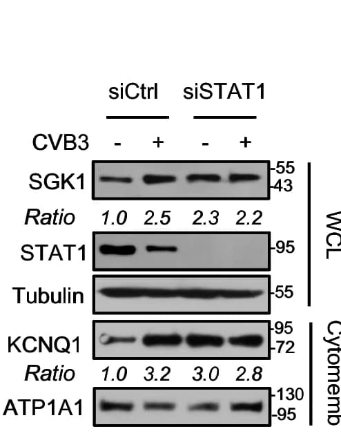 Open access visualization of Gel, Mice, siCtrl, siSTAT1, Tail Vein Injection