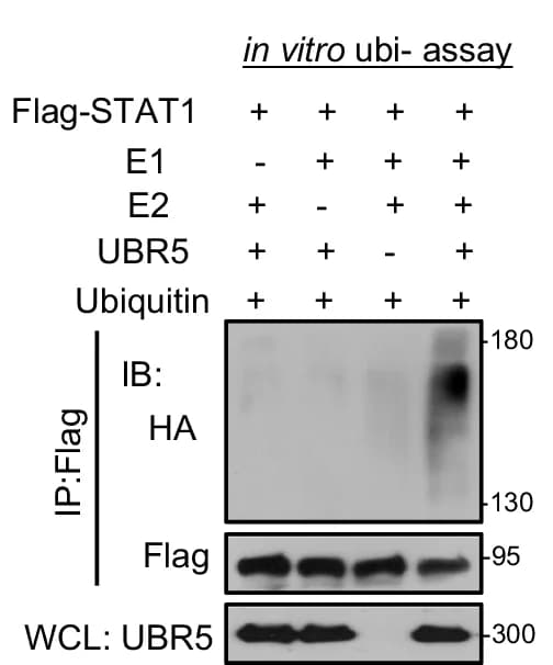 Open access visualization of Gel, In Vitro Ubiquitination Assay, Flag-STAT1, Ubiquitination, Recombinant UBR5 Proteins
