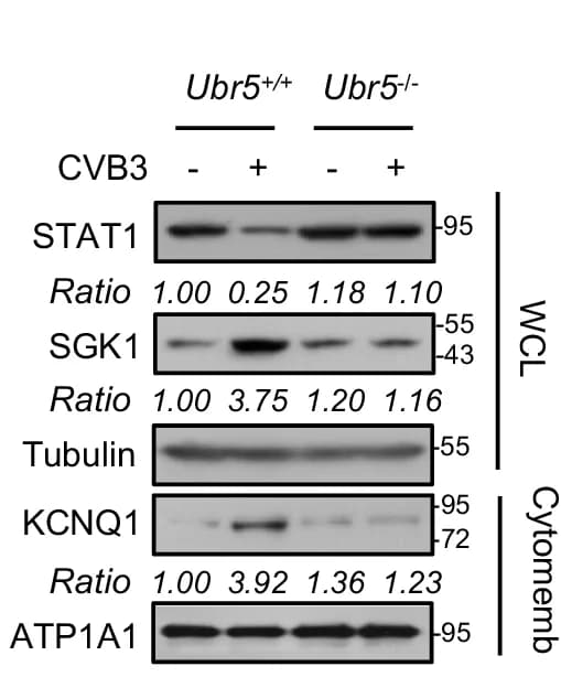 Open access visualization of Gel, Western Blot, STAT1, SGK1, KCNQ1