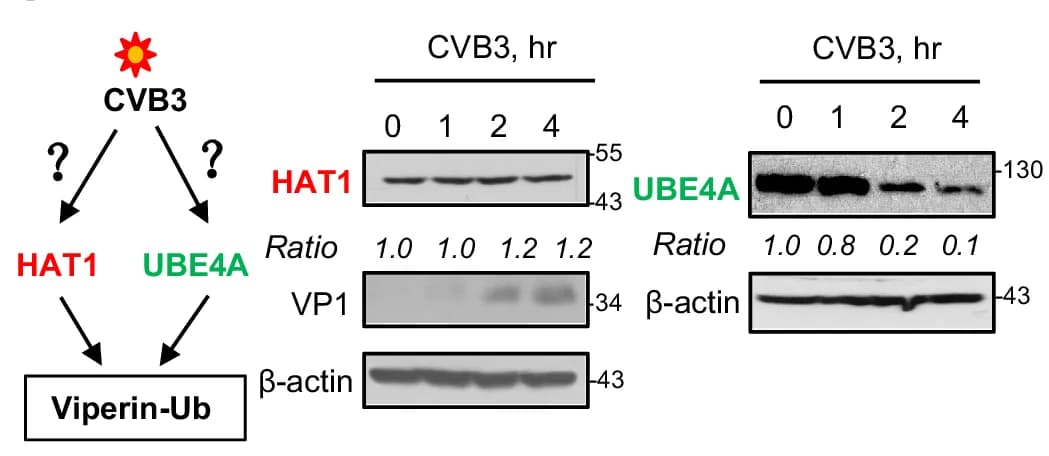 Open access visualization of Workflow, Gel, Western Blot, HAT1, UBE4A